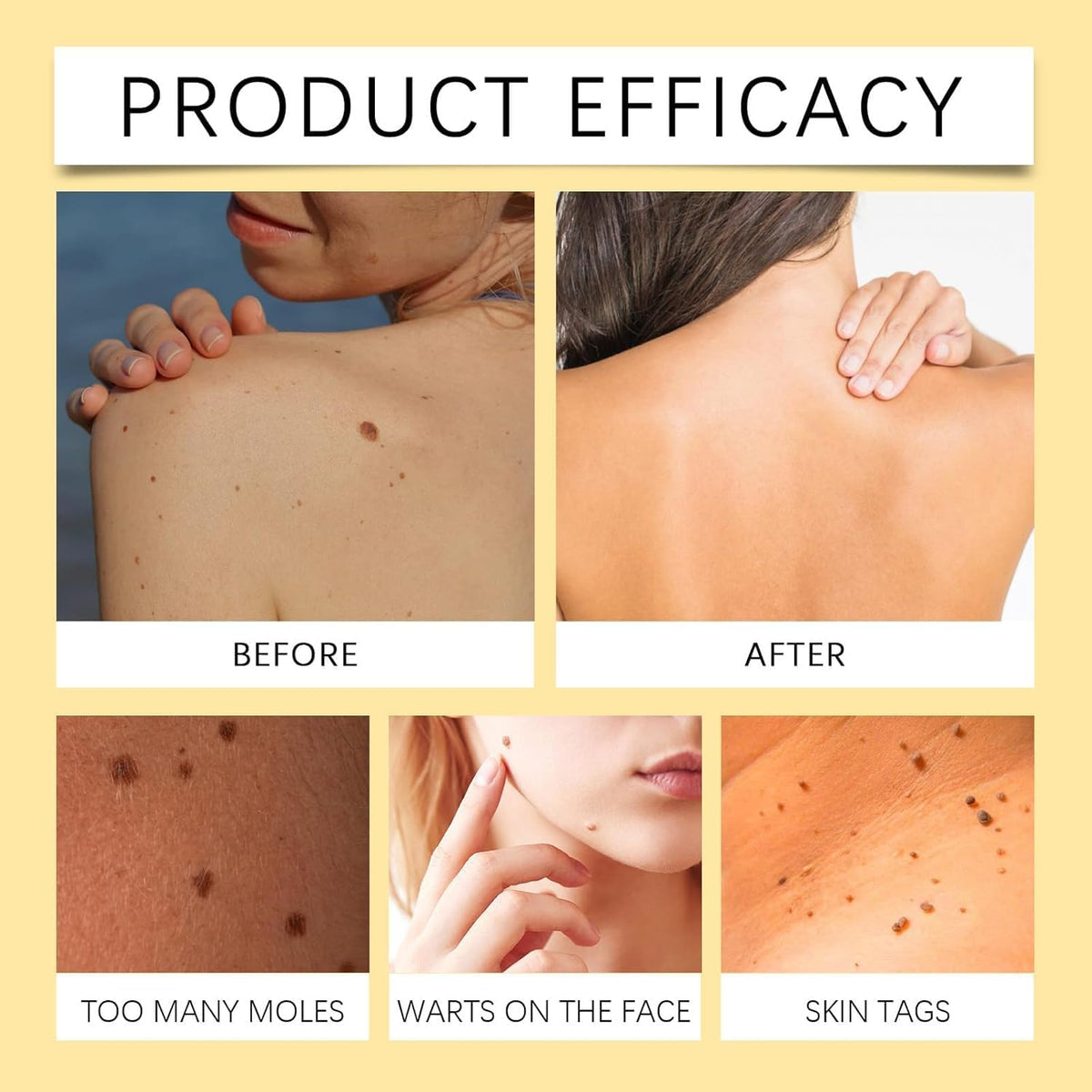Bee Venom Skin Treatment Cream 60G, Wrinkle Removal Cream for All Skin Types