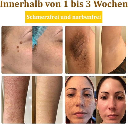 Bee Venom Skin Treatment Cream 60G, Wrinkle Removal Cream for All Skin Types